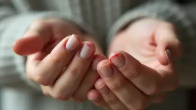 loupání kůže na rukou příčiny a řešení – Jak na loupání kůže na rukou: příčiny, prevence a léčba