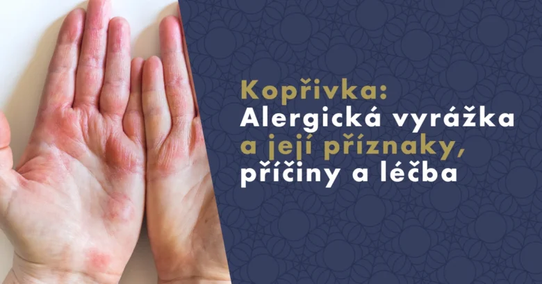 Ruce s kopřivkou - alergická vyrážka