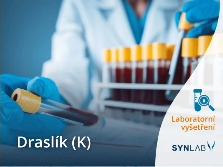 Laboratorní vyšetření draslíku v krvi