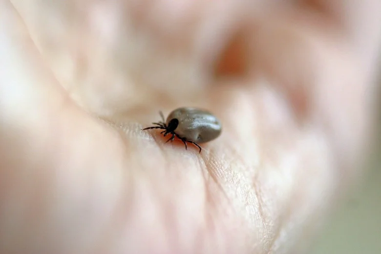 Bližší záběr na klíště na lidské kůži